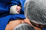 Mantenimento del punto nascita dell